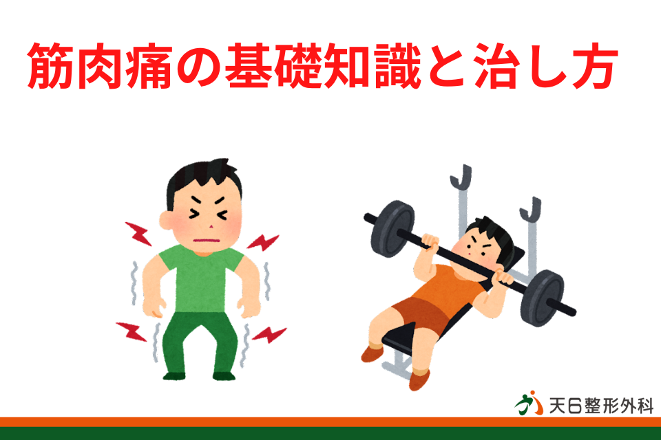 筋肉痛の基礎知識と治し方｜天神橋筋六丁目(天六)駅の整形外科｜天6